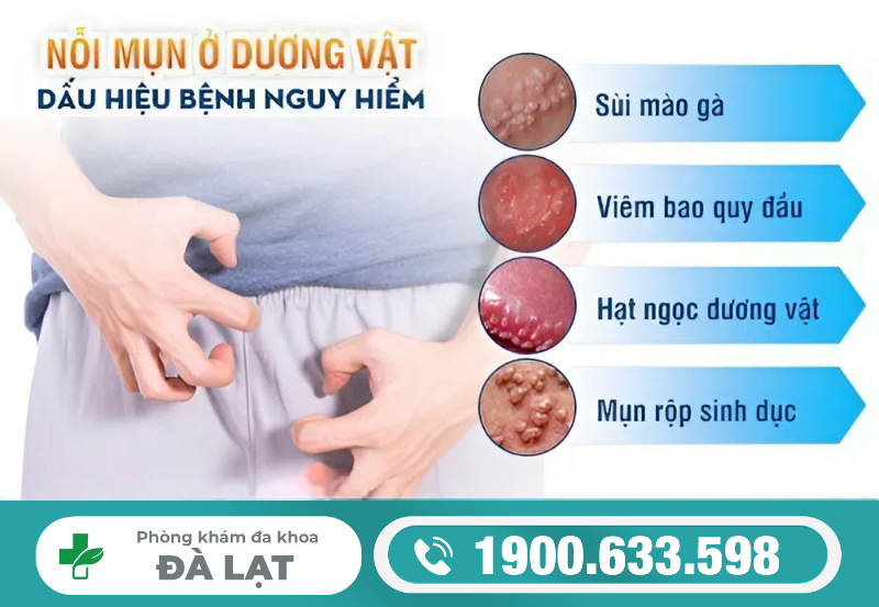 Hình ảnh minh họa